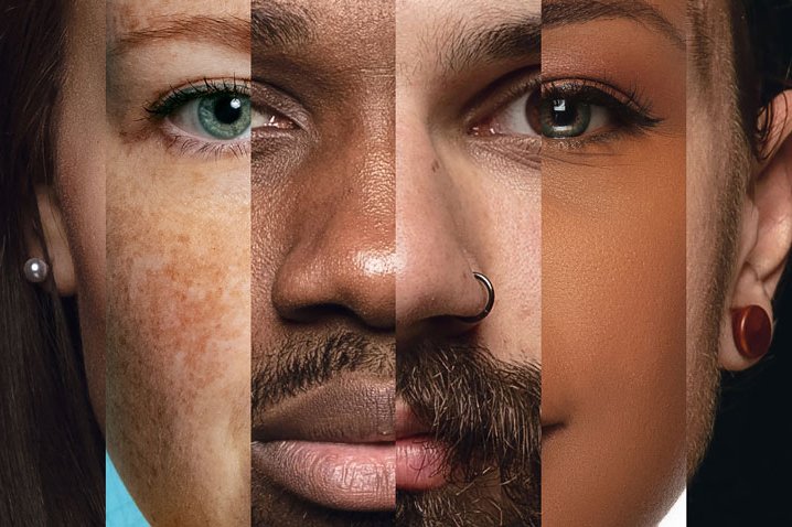 diversity